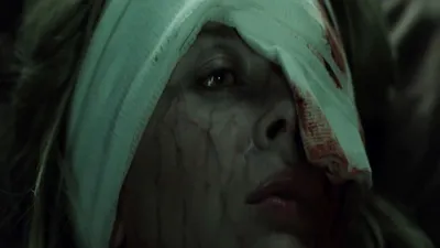 Feral izle