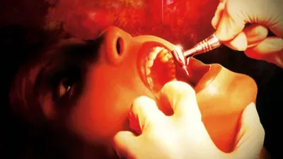 The Dentist izle