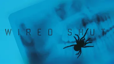 Wired Shut izle